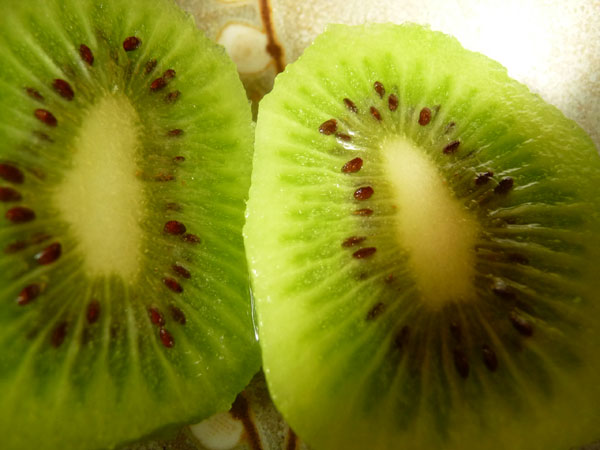 Garden design with Kiwi Fruit